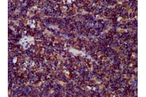IHC image of ABIN7147311 diluted at 1:400 and staining in paraffin-embedded human lymph node tissue performed on a Leica BondTM system.