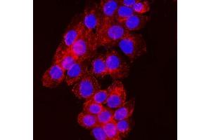 IF analysis of NDFIP2 using anti-NDFIP2 antibody (ABIN7600173).