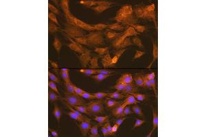Immunofluorescence analysis of C6 cells using PDI Rabbit mAb (ABIN7269615) at dilution of 1:100 (40x lens). (PDIA6 antibody)