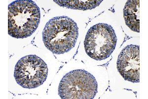 IHC analysis of AGRP using anti-AGRP antibody . (AGRP antibody  (AA 82-131))