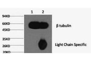 1) Input: Mouse brain tissue, 2) IP product: IP at dilution of 1: 200 (TUBB antibody)