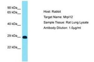 Image no. 1 for anti-Mitochondrial Ribosomal Protein L12 (MRPL12) (AA 119-168) antibody (ABIN6750517) (MRPL12 antibody  (AA 119-168))