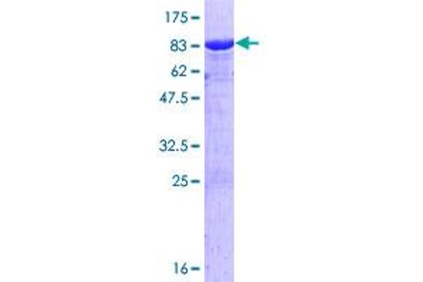 CTNNA1 Protein (AA 1-536) (GST tag)