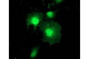 Anti-ZFAND2B mouse monoclonal antibody (ABIN2454175) immunofluorescent staining of COS7 cells transiently transfected by pCMV6-ENTRY ZFAND2B (RC203822). (ZFAND2B antibody)