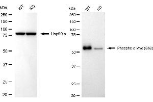 Western blotting analysis using phospho-c-Myc (S62) antibody (ABIN7799503). (Recombinant c-MYC antibody  (pSer62))