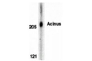 Western Blotting (WB) image for anti-Apoptotic Chromatin Condensation Inducer 1 (ACIN1) (C-Term) antibody (ABIN1030217) (ACIN1 antibody  (C-Term))