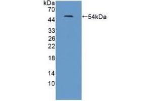 Detection of Recombinant LRRN1, Human using Polyclonal Antibody to Leucine Rich Repeat Neuronal Protein 1 (LRRN1) (LRRN1 antibody  (AA 418-631))