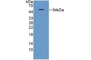 LRRN1 antibody  (AA 418-631)