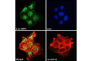 ABIN185451 Immunofluorescence analysis of paraformaldehyde fixed A431 cells, permeabilized with 0. (MEFV antibody  (Internal Region))