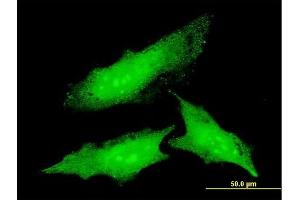 Immunofluorescence of monoclonal antibody to ODC1 on HeLa cell. (ODC1 antibody  (AA 1-461))