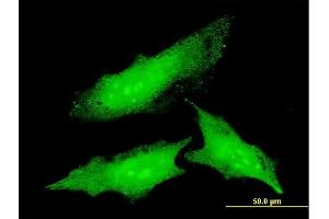 Immunofluorescence of monoclonal antibody to ODC1 on HeLa cell. (ODC1 antibody  (AA 1-461))