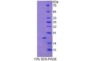 SDS-PAGE analysis of Human CNP Protein. (C-Type Natriuretic Peptide)