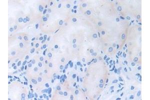 Detection of CDCP1 in Human Kidney Tissue using Polyclonal Antibody to CUB Domain Containing Protein 1 (CDCP1) (CDCP1 antibody  (AA 689-836))