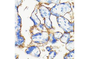 Immunohistochemistry of paraffin-embedded human placenta using [KO Validated] PD-L1/CD274 Rabbit mAb (ABIN7266178) at dilution of 1:100 (40x lens). (PD-L1 antibody)