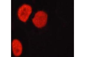 Immunofluorescence (fixed cells) (IF/ICC) image for anti-Histone Deacetylase 6 (HDAC6) (pSer22) antibody (ABIN6255100)