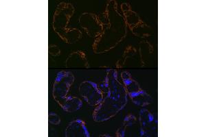 Immunofluorescence analysis of human placenta cells using CYP26 Rabbit mAb (ABIN7266654) at dilution of 1:100 (40x lens). (CYP26A1 antibody)