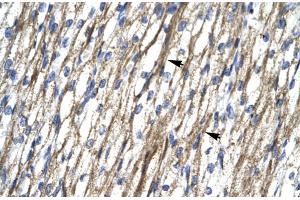 Rabbit Anti-RBM10 Antibody  Paraffin Embedded Tissue: Human Heart Cellular Data: Myocardial cells Antibody Concentration: 4. (RBM10 antibody  (N-Term))