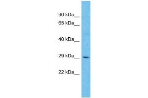 Western Blotting (WB) image for anti-Zinc Finger, DHHC-Type Containing 22 (ZDHHC22) (C-Term) antibody (ABIN2791997) (ZDHHC22 antibody  (C-Term))