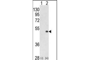 Western blot analysis of PCTK1 (arrow) using rabbit polyclonal PCTK1 C-term (ABIN391247 and ABIN2837844). (CDK16 antibody  (N-Term))