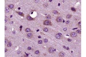 Paraformaldehyde-fixed, paraffin embedded mouse brain, Antigen retrieval by boiling in sodium citrate buffer (pH6) for 15min, Block endogenous peroxidase by 3% hydrogen peroxide for 30 minutes, Blocking buffer (normal goat serum) at 37°C for 20min, Antibody incubation with RNF128 Polyclonal Antibody (bs-9251R) at 1:400 overnight at 4°C, followed by a conjugated secondary and DAB staining. (RNF128 antibody)