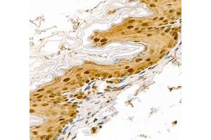 Immunohistochemistry (Paraffin-embedded Sections) (IHC (p)) image for anti-Transketolase (TKT) antibody (ABIN7075978)