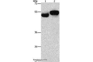 Western blot analysis of Human fetal brain and liver tissue, using AMZ1 Polyclonal Antibody at dilution of 1:1000 (AMZ1 antibody)