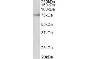 Western Blotting (WB) image for anti-Far Upstream Element (FUSE) Binding Protein 1 (FUBP1) (AA 160-174) antibody (ABIN5900708) (FUBP1 antibody  (AA 160-174))