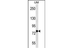 Western blot analysis in uterus tumor cell line lysates (35ug/lane). (DNAJC14 antibody  (AA 184-213))