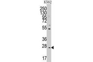 Western blot analysis of CD8B polyclonal antibody  in K-562 cell line lysates (35 ug/lane). (CD8B antibody  (N-Term))