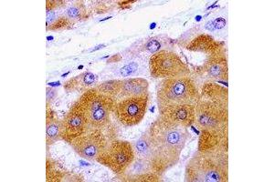 Immunohistochemical analysis of METTL7A staining in rat liver  formalin fixed paraffin embedded tissue section. (METTL7A antibody)