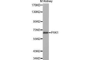 Western Blotting (WB) image for anti-P21-Activated Kinase 1 (PAK1) (AA 1-240) antibody (ABIN3023361) (PAK1 antibody  (AA 1-240))