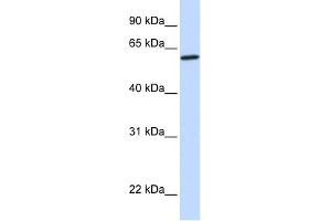 WB Suggested Anti-CYP27A1 Antibody Titration: 0. (CYP27A1 antibody  (Middle Region))