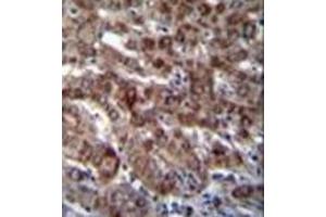 Immunohistochemistry (Paraffin-embedded Sections) (IHC (p)) image for anti-Aspartyl-tRNA Synthetase (DARS) (AA 161-190), (N-Term) antibody (ABIN951837)