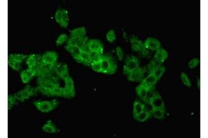 Immunofluorescent analysis of HepG2 cells using ABIN7157384 at dilution of 1:100 and Alexa Fluor 488-congugated AffiniPure Goat Anti-Rabbit IgG(H+L) (KRT14 antibody  (AA 1-472))