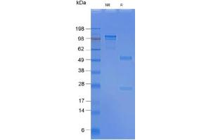SDS-PAGE gel: 2. (Recombinant SSEA-4 antibody)