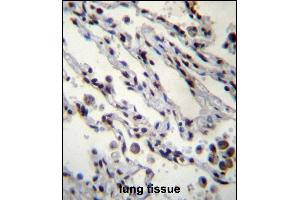 HIST1H2BN Antibdy (N-term) (ABIN657039 and ABIN2846210) immunohistochemistry analysis in formalin fixed and paraffin embedded human lung tissue followed by peroxidase conjugation of the secondary antibody and DAB staining. (HIST1H2BN antibody  (N-Term))
