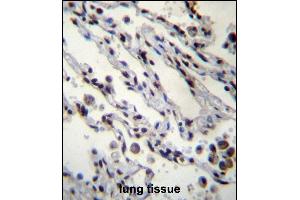 Immunohistochemistry (Paraffin-embedded Sections) (IHC (p)) image for anti-Histone H2B Type 1-N (HIST1H2BN) (AA 1-30), (N-Term) antibody (ABIN657039)