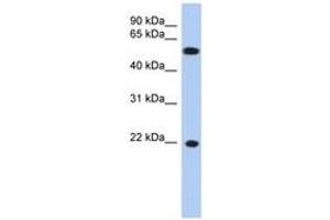 Image no. 1 for anti-Crystallin, gamma C (CRYGC) (AA 71-120) antibody (ABIN6743634) (CRYGC antibody  (AA 71-120))