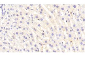 Detection of VCAM1 in Mouse Liver Tissue using Polyclonal Antibody to Vascular Cell Adhesion Molecule 1 (VCAM1) (VCAM1 antibody  (AA 511-682))