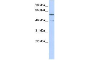 WB Suggested Anti-ZNF284 Antibody Titration:  0. (ZNF284 antibody  (C-Term))
