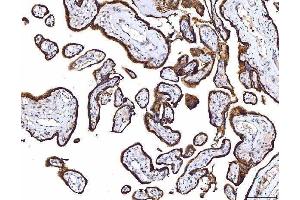 IHC analysis of CD55 using anti-CD55 antibody (ABIN7601423).