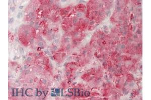 IHC-P analysis of Human Adrenal Gland Tissue, with HE staining. (Neuropilin 1 antibody  (AA 646-814))