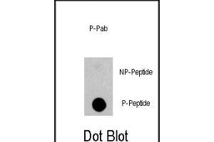 Dot blot analysis of anti-EGFR-p Phospho-specific Pab (ABIN1944845 and ABIN2839700) on nitrocellulose membrane. (EGFR antibody  (pSer1070))