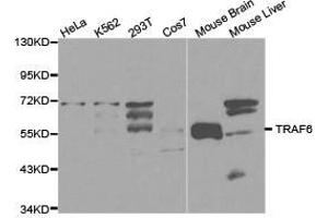 Western Blotting (WB) image for anti-TNF Receptor-Associated Factor 6 (TRAF6) antibody (ABIN1875195)