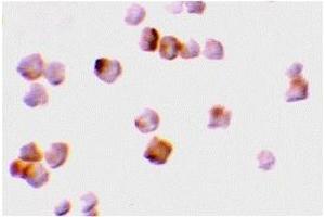 Western Blotting (WB) image for anti-Caspase 2, Apoptosis-Related Cysteine Peptidase (CASP2) (N-Term) antibody (ABIN1031296)