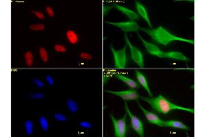HDAC2 mAb (Clone 3F3) tested by immunofluorescence. (HDAC2 antibody  (AA 473-488))