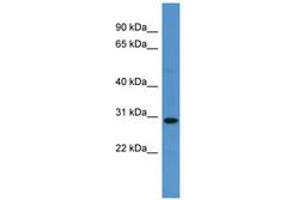 Image no. 1 for anti-Sprouty-Related, EVH1 Domain Containing 2 (SPRED2) (AA 317-366) antibody (ABIN6746817) (SPRED2 antibody  (AA 317-366))