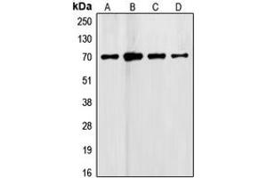 Western blot analysis of Follistatin expression in HeLa (A), C6 (B), HepG2 (C), Jurkat (D) whole cell lysates. (Follistatin antibody  (Center))
