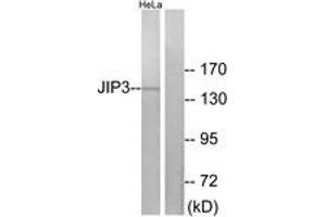 Western blot analysis of extracts from HeLa cells, using JIP3 Antibody. (JIP3 antibody  (AA 621-670))