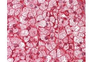 Human Adrenal: Formalin-Fixed, Paraffin-Embedded (FFPE) (CYP21A2 antibody  (AA 216-246))